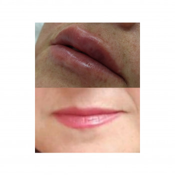 Прибрали ассиметрію губ.