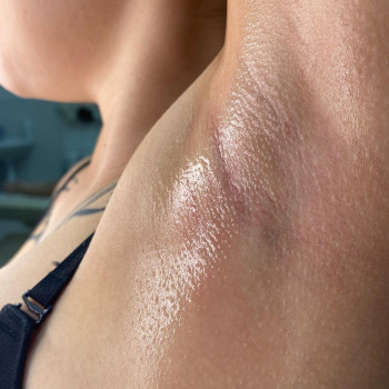 Видалення волосся пастою під пахвами 
150 грн