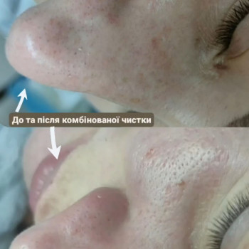 Марія Черненко, Черкассы Фото - 5