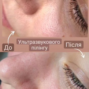 Марія Черненко, Черкассы Фото - 6