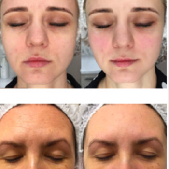 Олександра Швець, Київ Фото - 5