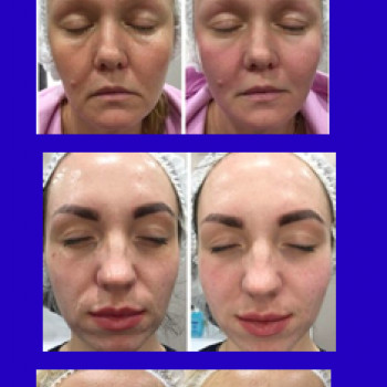 Олександра Швець, Київ Фото - 6