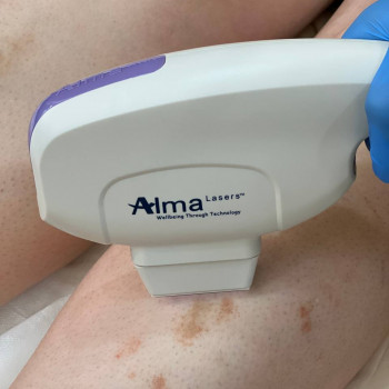 Лікування псоріазу
                    Косметологический центр Клініка естетичної медицини Мирослави Новосільської Ужгород