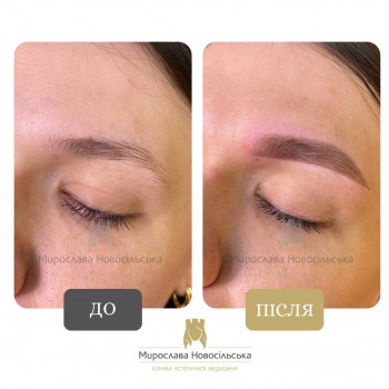 Пудрове напилення брів
                    Косметологический центр Клініка естетичної медицини Мирослави Новосільської Ужгород