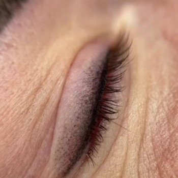 Пудрове напилення Війковий край: верхню повіку
                    Косметологический центр Клініка естетичної медицини Мирослави Новосільської Ужгород