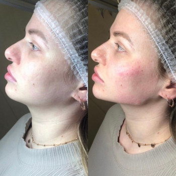 Профіль "Джолі"
                    Парикмахерская Надия Кривой Рог