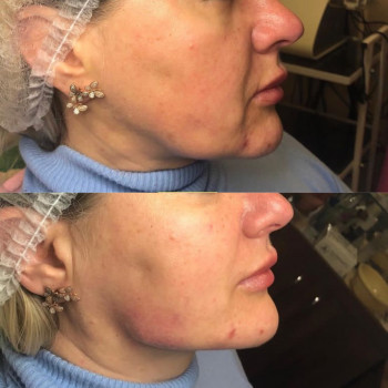 Профіль "Джолі"
                    Парикмахерская Надия Кривой Рог