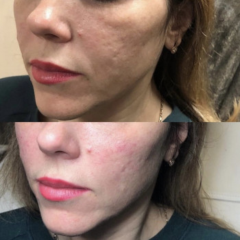 Корекція Вилиць
                    Перукарня Надия Кривий Ріг