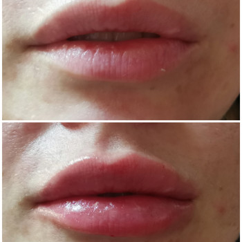 Наталья Анжуйская, Запоріжжя Фото - 34