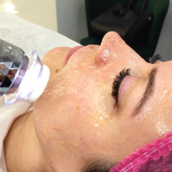 Апаратна карбоксітерапія
                    Косметолог Міла Київ