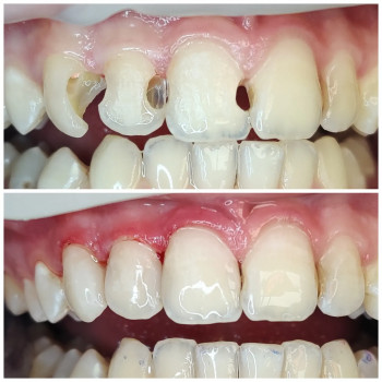 Деніель Логойда, Мукачево Фото - 5