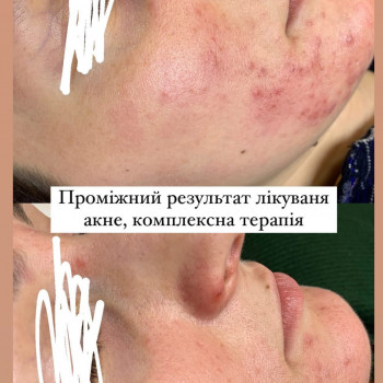 Олена Смульська, Хмельницький Фото - 42