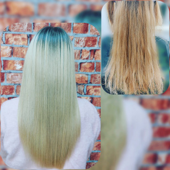 Органопластія