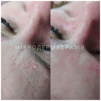 Олена Стрєлкова, Миргород Фото - 49