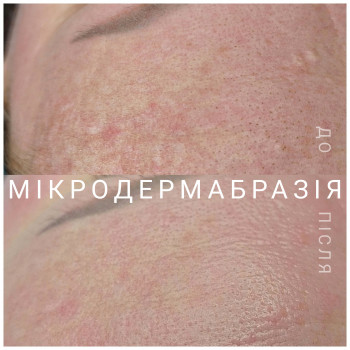 Олена Стрєлкова, Миргород Фото - 63