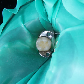 Фото з портфоліо фахівця Борис Прийма (стоматолог, Рівне)