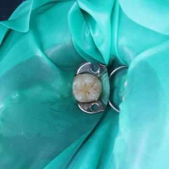 Фото з портфоліо фахівця Борис Прийма (стоматолог, Рівне)