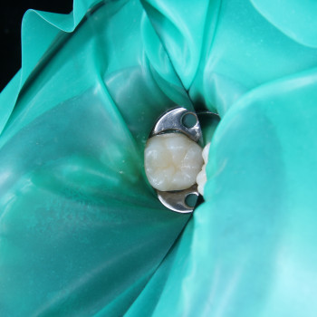 Фото з портфоліо фахівця Борис Прийма (стоматолог, Рівне)