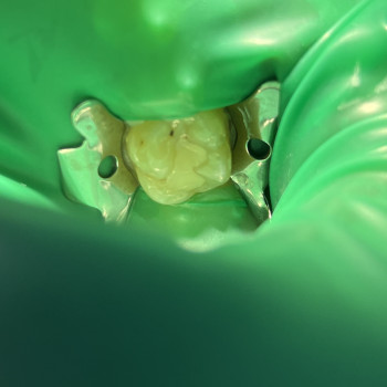 Фото з портфоліо фахівця Борис Прийма (стоматолог, Рівне)