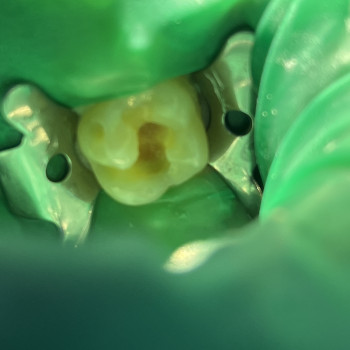 Фото з портфоліо фахівця Борис Прийма (стоматолог, Рівне)