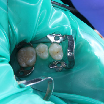 Фото з портфоліо фахівця Борис Прийма (стоматолог, Рівне)