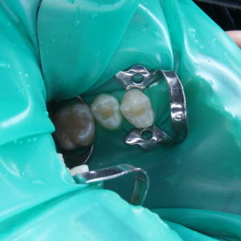 Фото з портфоліо фахівця Борис Прийма (стоматолог, Рівне)