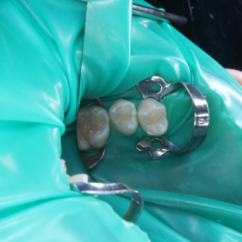 Фото з портфоліо фахівця Борис Прийма (стоматолог, Рівне)