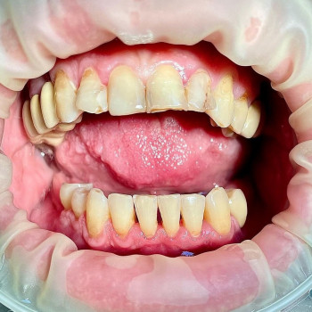 Сучасна стоматологія Dental Clinic, Кривой Рог Фото - 20