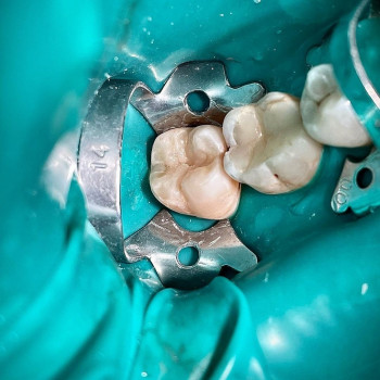 Сучасна стоматологія Dental Clinic, Кривой Рог Фото - 35