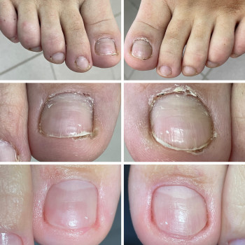 Естетичний педикюр