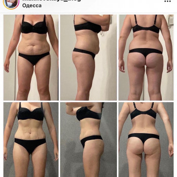 Массаж СТАРВАК для тела антицеллюлитный/моделирующий
                    Косметолог Елена Одесса