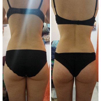 Магістральний лімфодренаж. Лімфодренажний масаж/ Магистральный лимфодренаж. Лимфодренажный массаж
                    Массажист Ирина Днепр