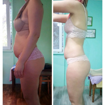 Магістральний лімфодренаж. Лімфодренажний масаж/ Магистральный лимфодренаж. Лимфодренажный массаж
                    Массажист Ирина Днепр