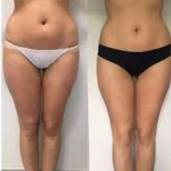 Юлія Дідарова, Одеса Фото - 1