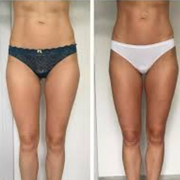 Юлія Дідарова, Одеса Фото - 2