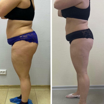 Юлія Дідарова, Одеса Фото - 4