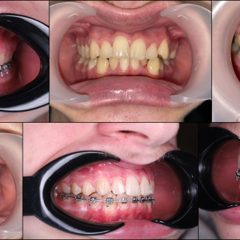 Лілія Білинець, Ужгород Фото - 13