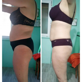 Антицелюлітний масаж. Корекція фігури. Магістральний лімфодренаж / Антицеллюлитный массаж. Коррекция фигуры. Магистральный лимфодренаж
                    Массажист Ирина Днепр