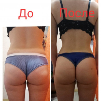 Антицелюлітний масаж. Корекція фігури. Магістральний лімфодренаж / Антицеллюлитный массаж. Коррекция фигуры. Магистральный лимфодренаж
                    Массажист Ирина Днепр