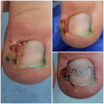 Тетяна Сметанка, Одеса Фото - 52