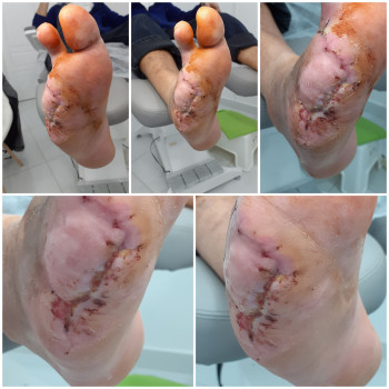 Тетяна Сметанка, Одеса Фото - 53