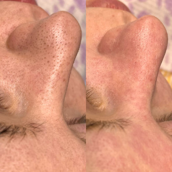 Яна Кроль, Черновцы Фото - 4