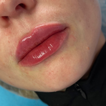 Яна Кроль, Черновцы Фото - 5