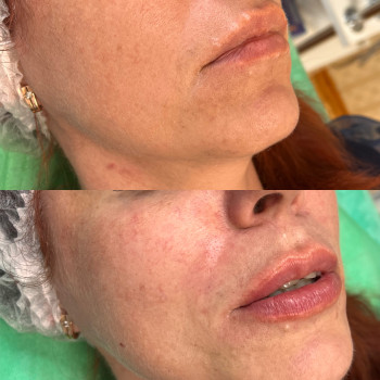 Яна Кроль, Черновцы Фото - 6