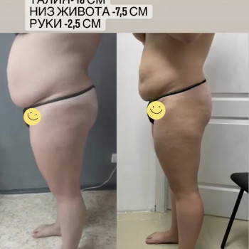 Taping Center, Южноукраїнськ Фото - 3