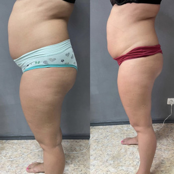 Taping Center, Южноукраїнськ Фото - 4