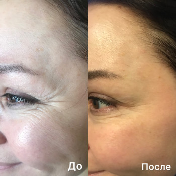 Натали Ткаченко, Киев Фото - 41