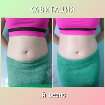 Результат однієї процедури