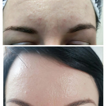 Тетяна Дем'яник, Богородчани Фото - 8