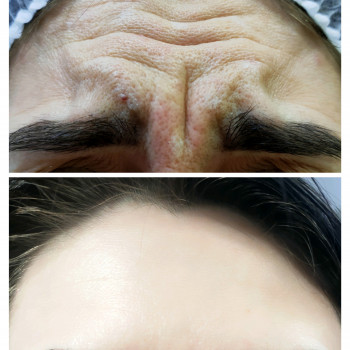 Тетяна Дем'яник, Богородчани Фото - 10